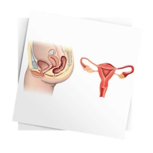 Anatomisk bildeblokk dame